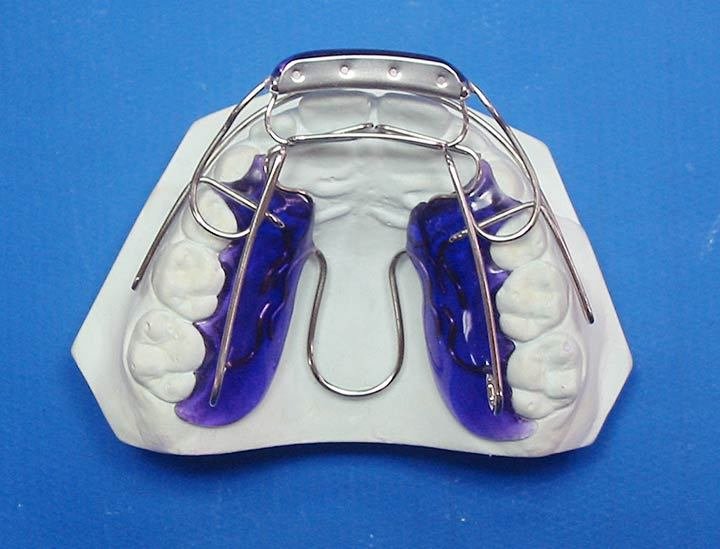 Ortodontia e Ortopedia | Elosul Passo Fundo